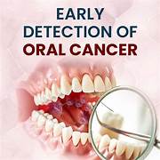 Oral Cancer